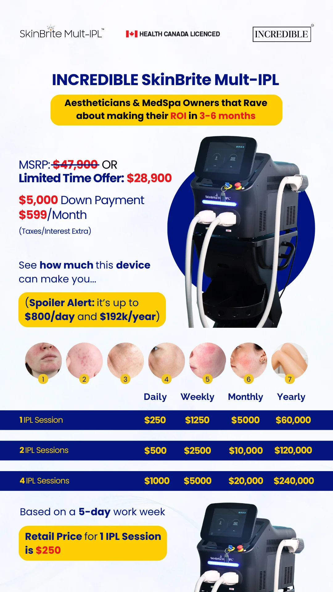 AD MOB Banner INCREDIBLE SkinBrite Mult IPL Return on Investment AW April 2025 Aesthetics Depot