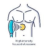 EMS MAXX Body Trim & Tone™ Device Aesthetics Depot image15 1 Aesthetics Depot