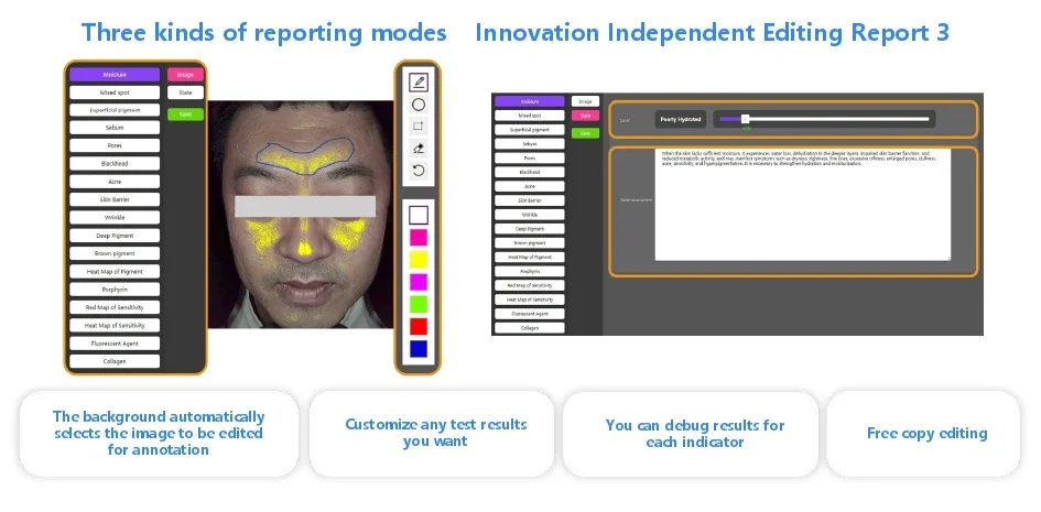 Reporting Mode 3 Aesthetics Depot