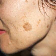 image11 Aesthetics Depot