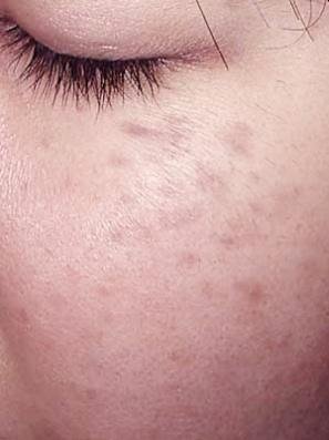 image12 Aesthetics Depot