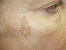 image14 Aesthetics Depot