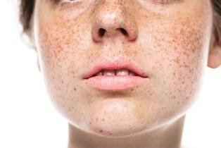 image15 2 Aesthetics Depot