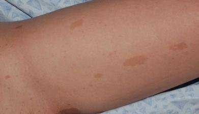 image16 Aesthetics Depot