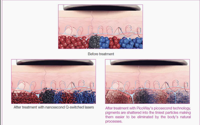 image355 Aesthetics Depot