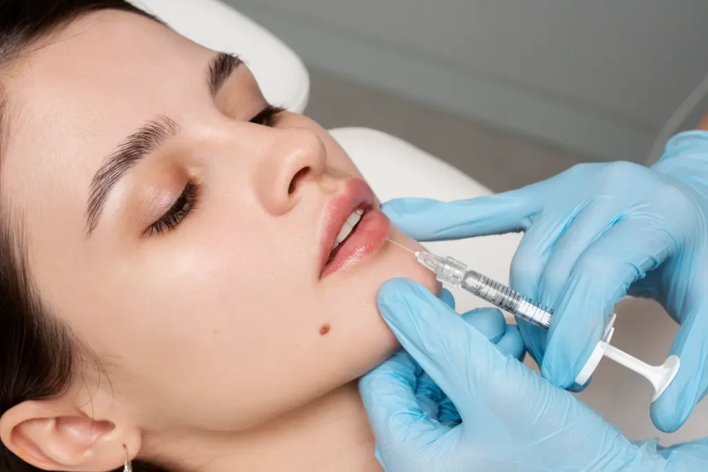 dermal fillers