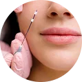 Thread-Lift