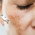 Mesotherapy
