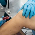 Orthopedics Fillers